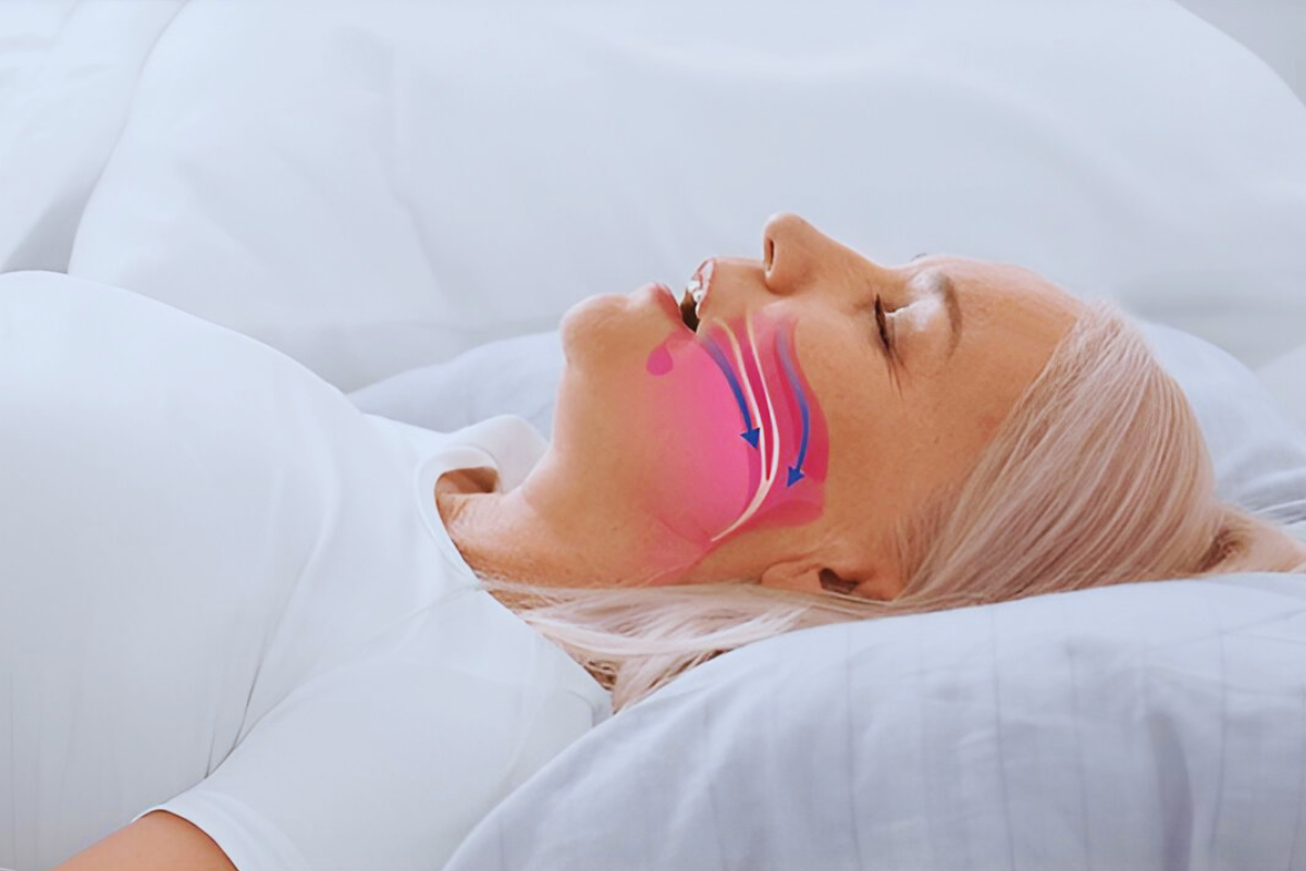 Sleeping with Mouth Open